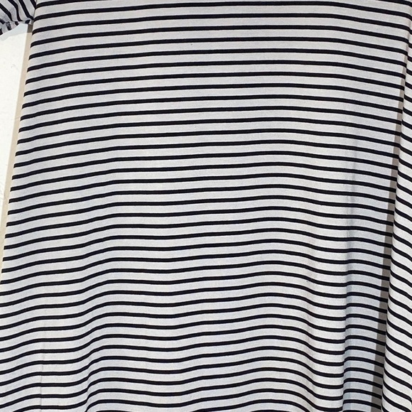 ✅ Bundle of two LulaRoe Oversized Casual  Dress Sz XS Stripped/ Bohemian Print - Picture 9 of 16